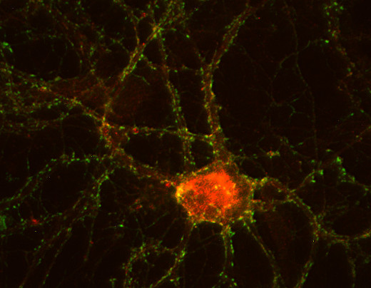 Clathrin light chain Monoclonal mouse purified IgG - image 2