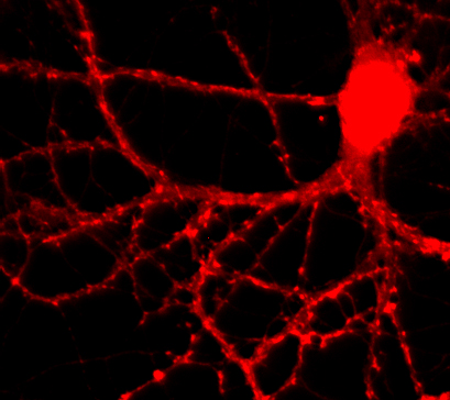 Dynamin1/2/3 Polyclonal rabbit antiserum - image 2