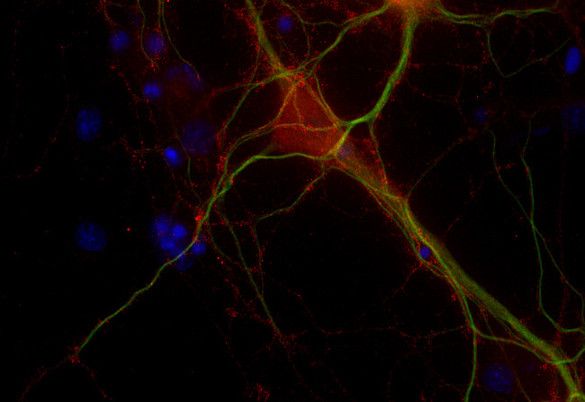 Dynamin1/2/3 Polyclonal rabbit purified antibody - image 2