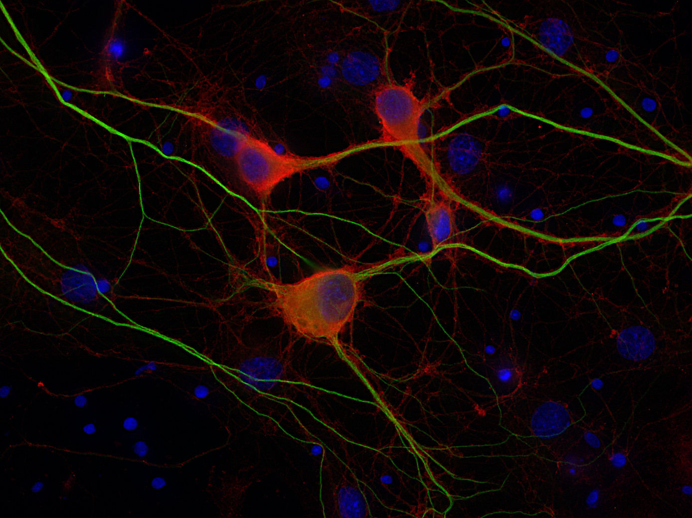 Munc18-1 Recombinant rabbit - image 2