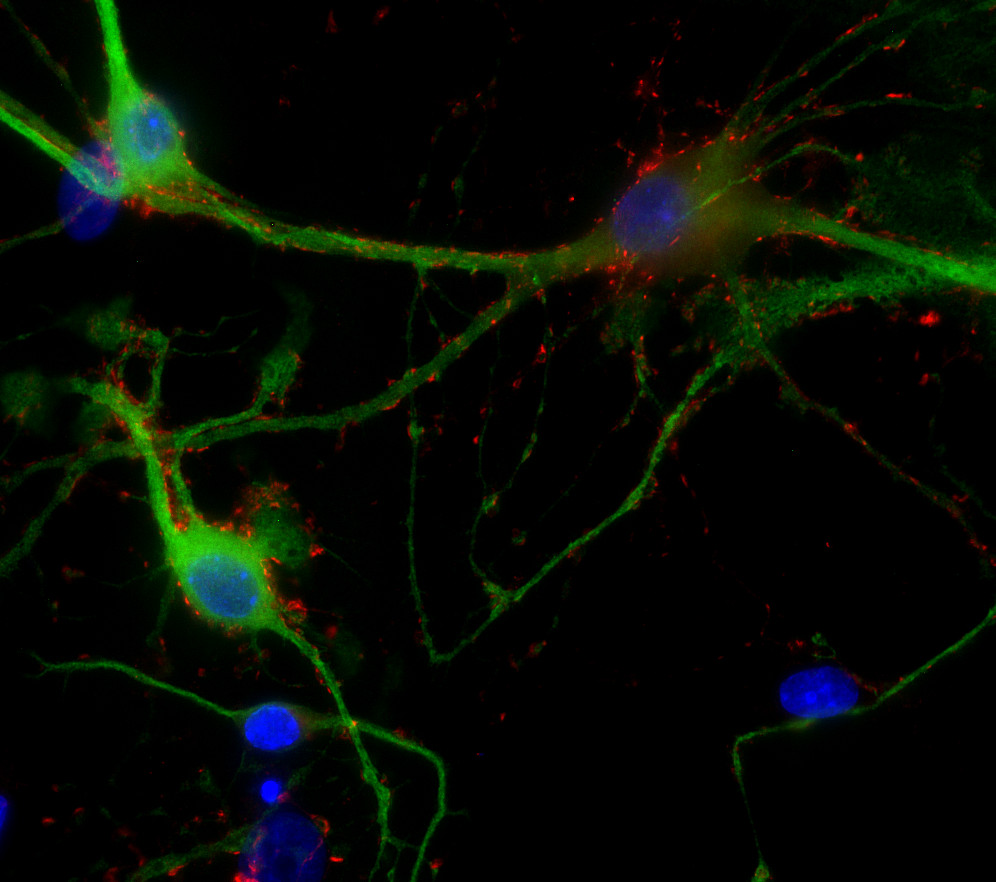 SV2 A Polyclonal rabbit antiserum - image 2