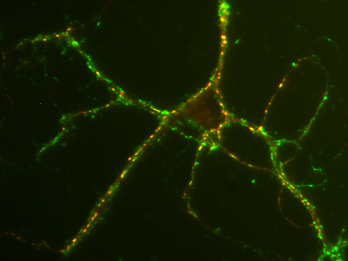 SV2 C Polyclonal rabbit antiserum - image 2