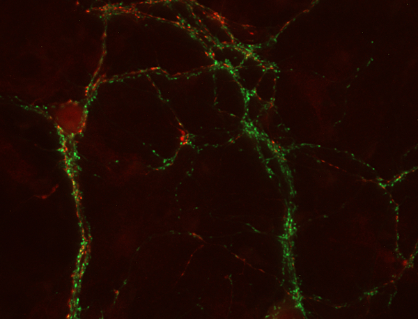 SV2 C Polyclonal Guinea pig antiserum - image 2
