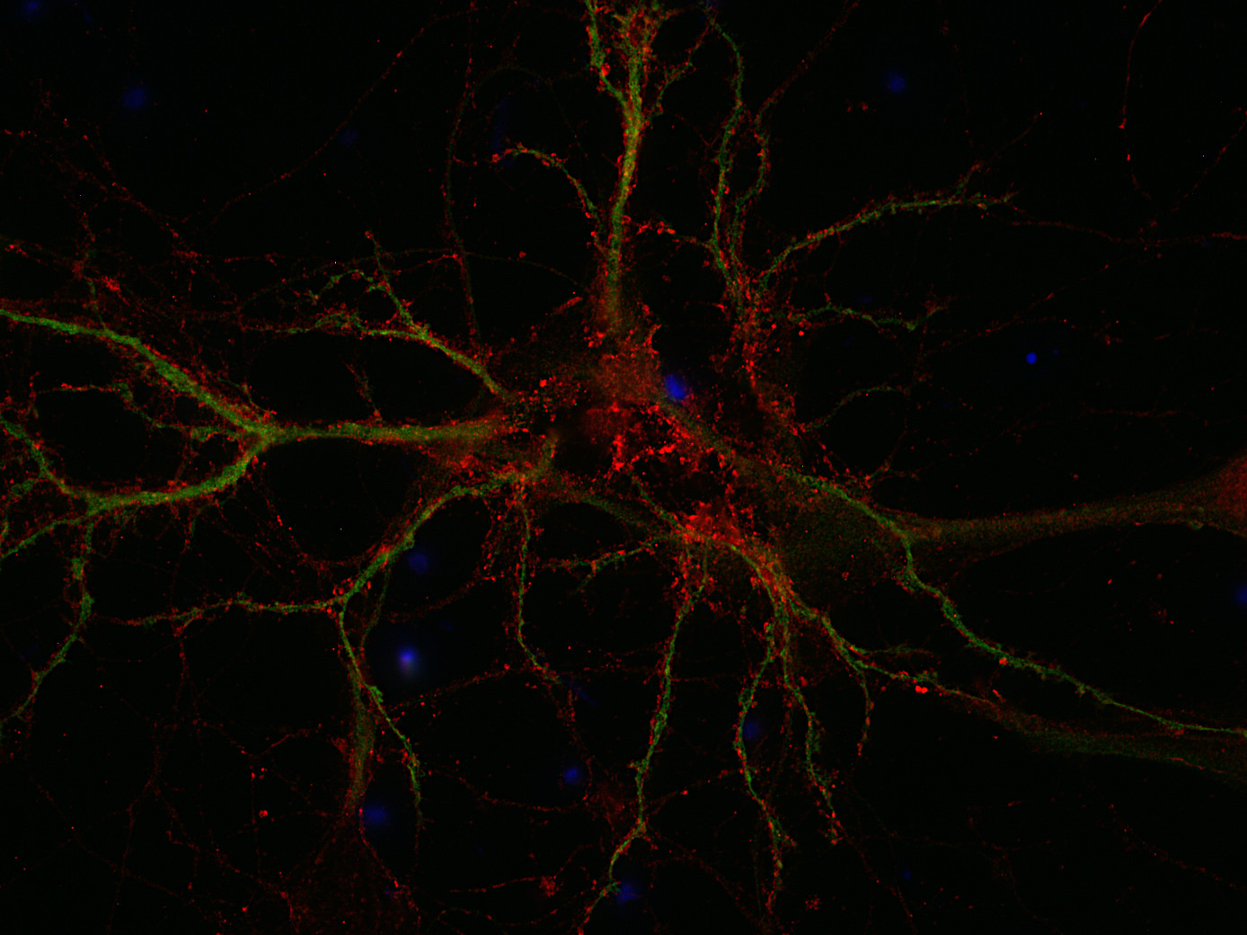 SCAMP1 Polyclonal rabbit antiserum - image 2