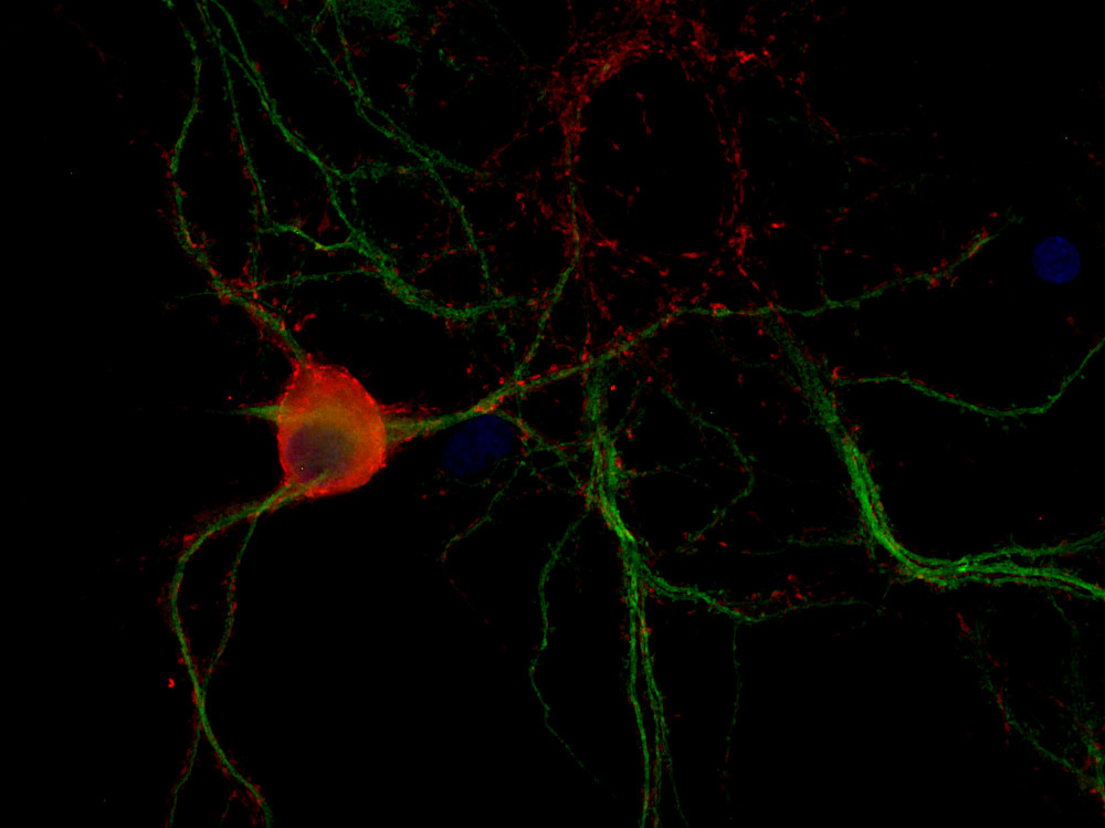 Complexin1/2 Polyclonal rabbit antiserum - image 2