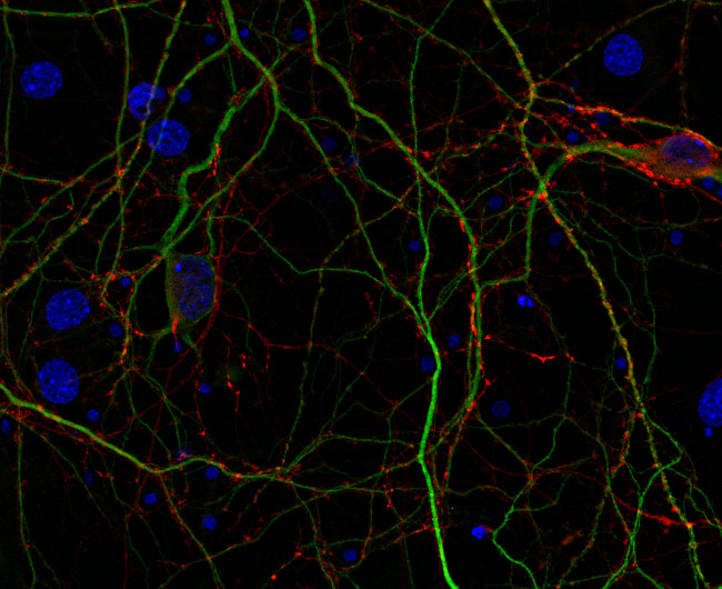 Complexin1/2 Polyclonal rabbit purified antibody - image 2