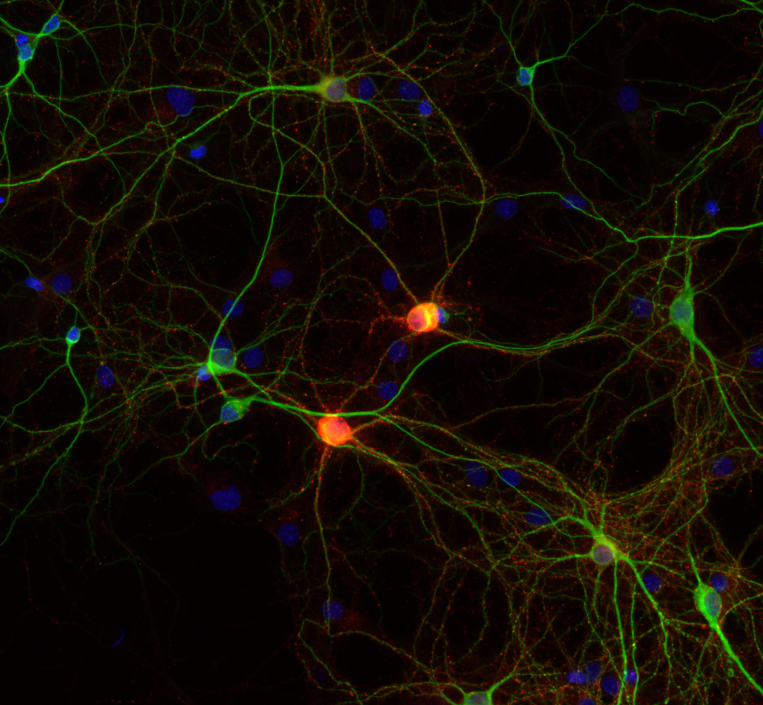 Complexin2, Polyclonal rabbit purified antibody