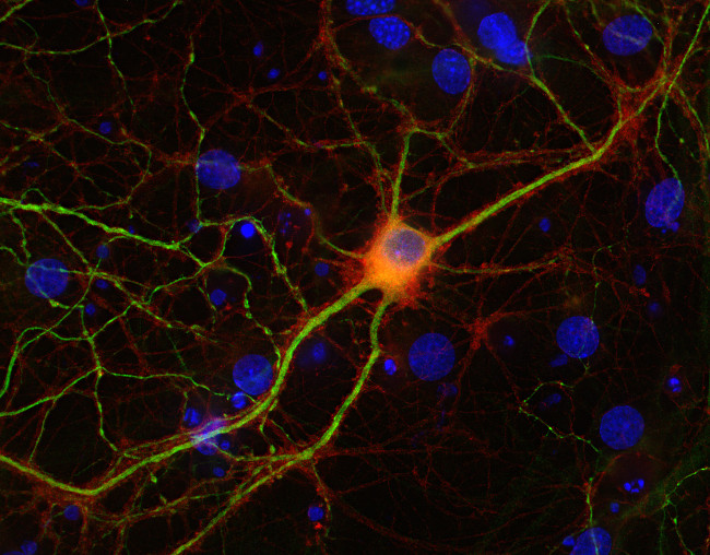 NSF Polyclonal Guinea pig antiserum - image 2