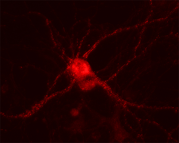 Munc13-1 Polyclonal Guinea pig antiserum - image 2