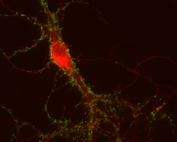 APP Polyclonal rabbit purified antibody - image 3