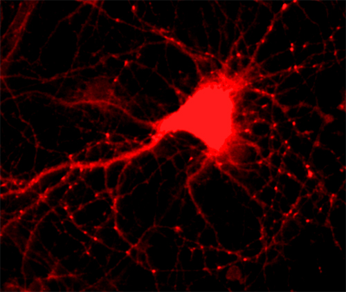 alpha/beta Synuclein Polyclonal rabbit antiserum - image 2