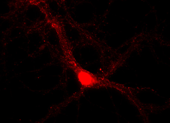 alpha/beta Synuclein Polyclonal rabbit purified antibody - image 2