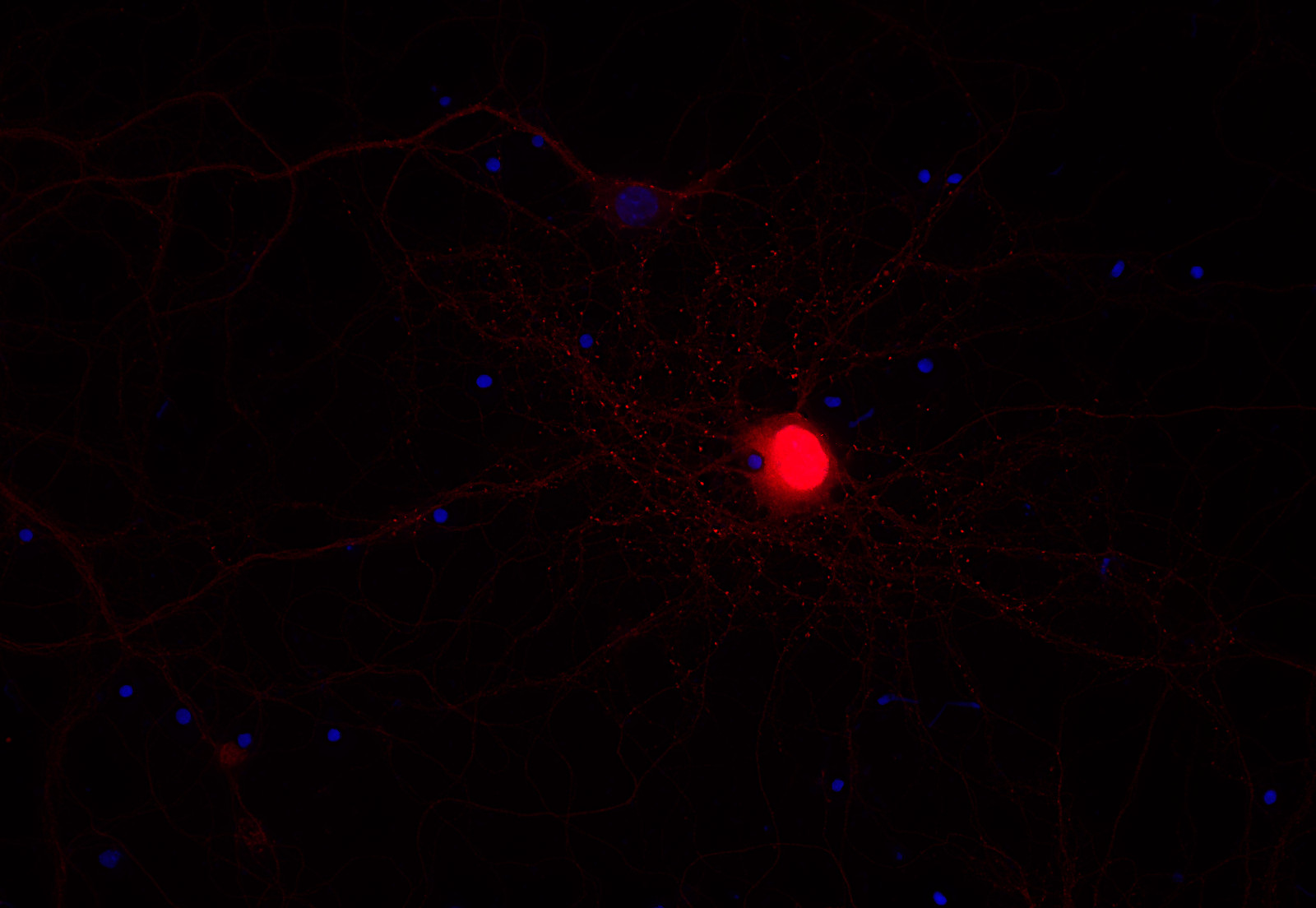 alpha Synuclein Recombinant rabbit - image 2