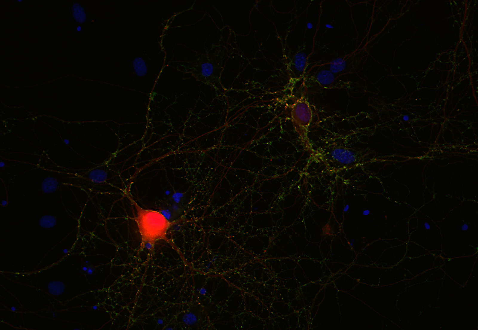 alpha Synuclein Recombinant rabbit - image 3
