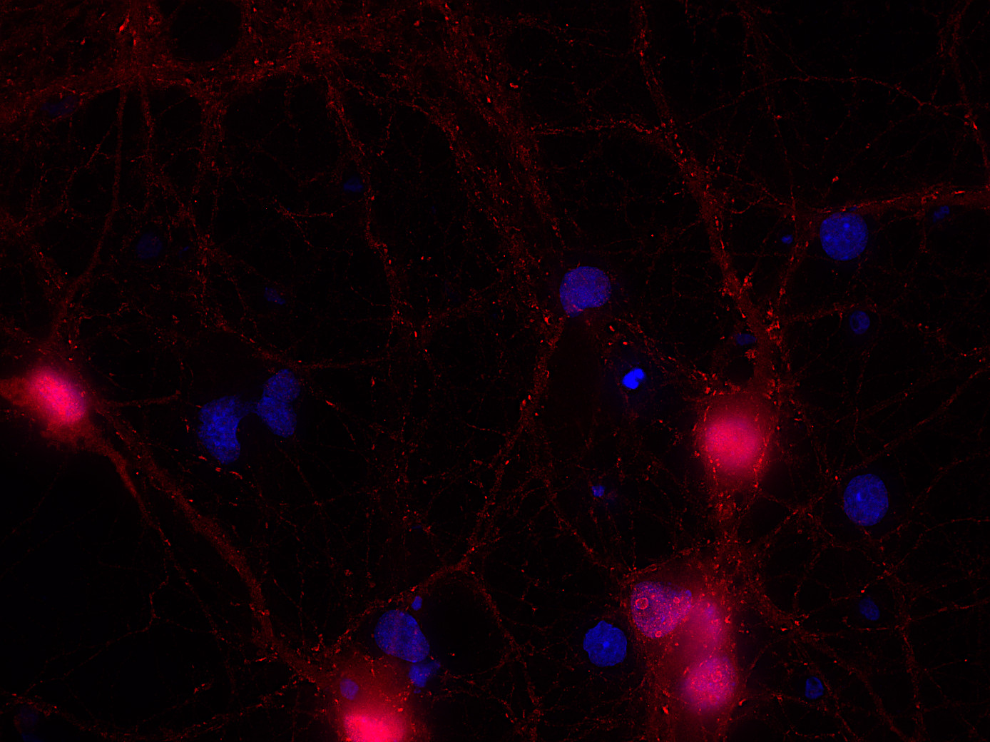 beta-Synuclein Polyclonal rabbit purified antibody - image 2