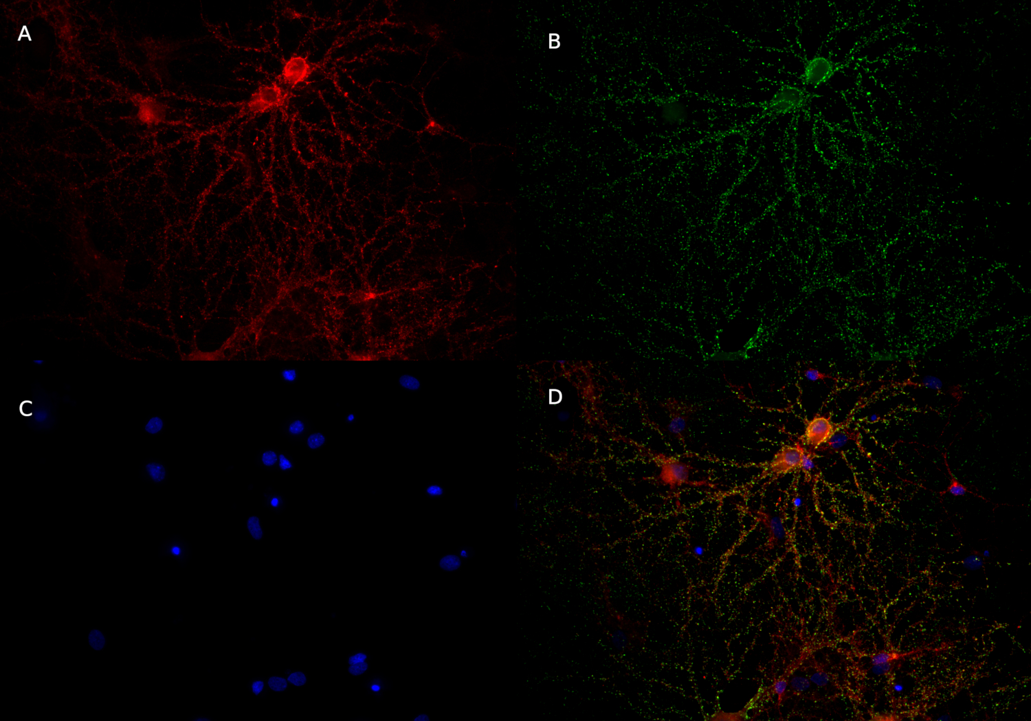 Neuroligin3 Recombinant rabbit - image 2