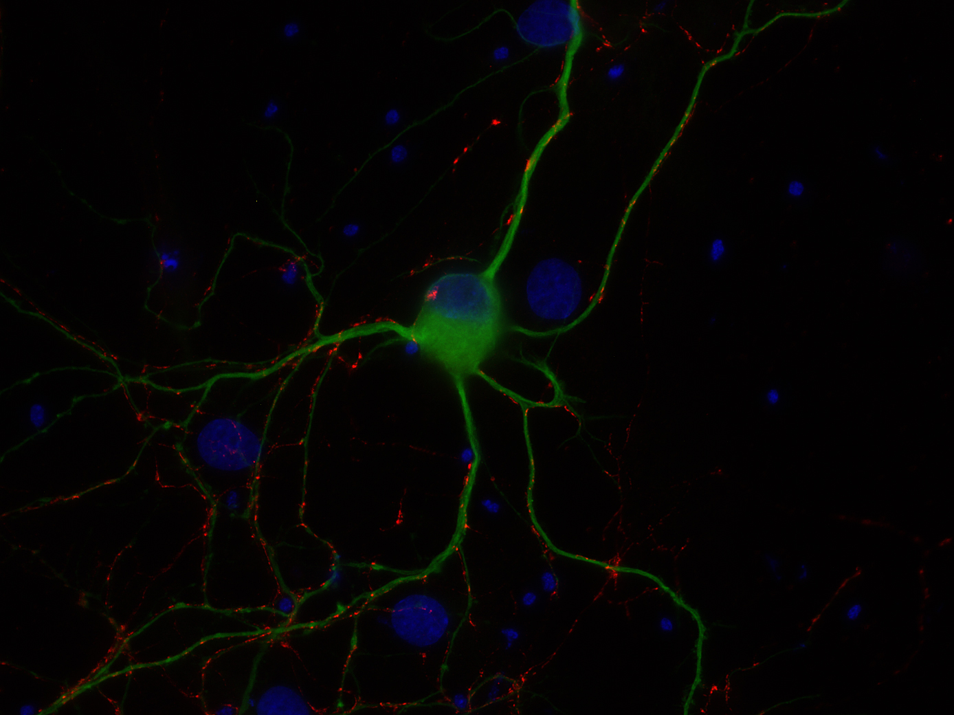 VGAT Recombinant rabbit - image 3