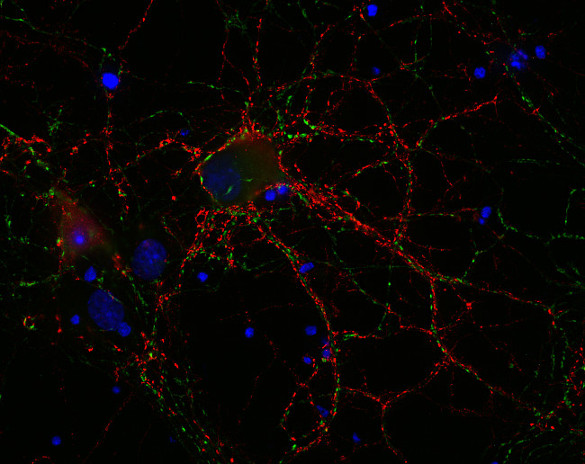VGLUT1 Polyclonal rabbit antiserum - image 3