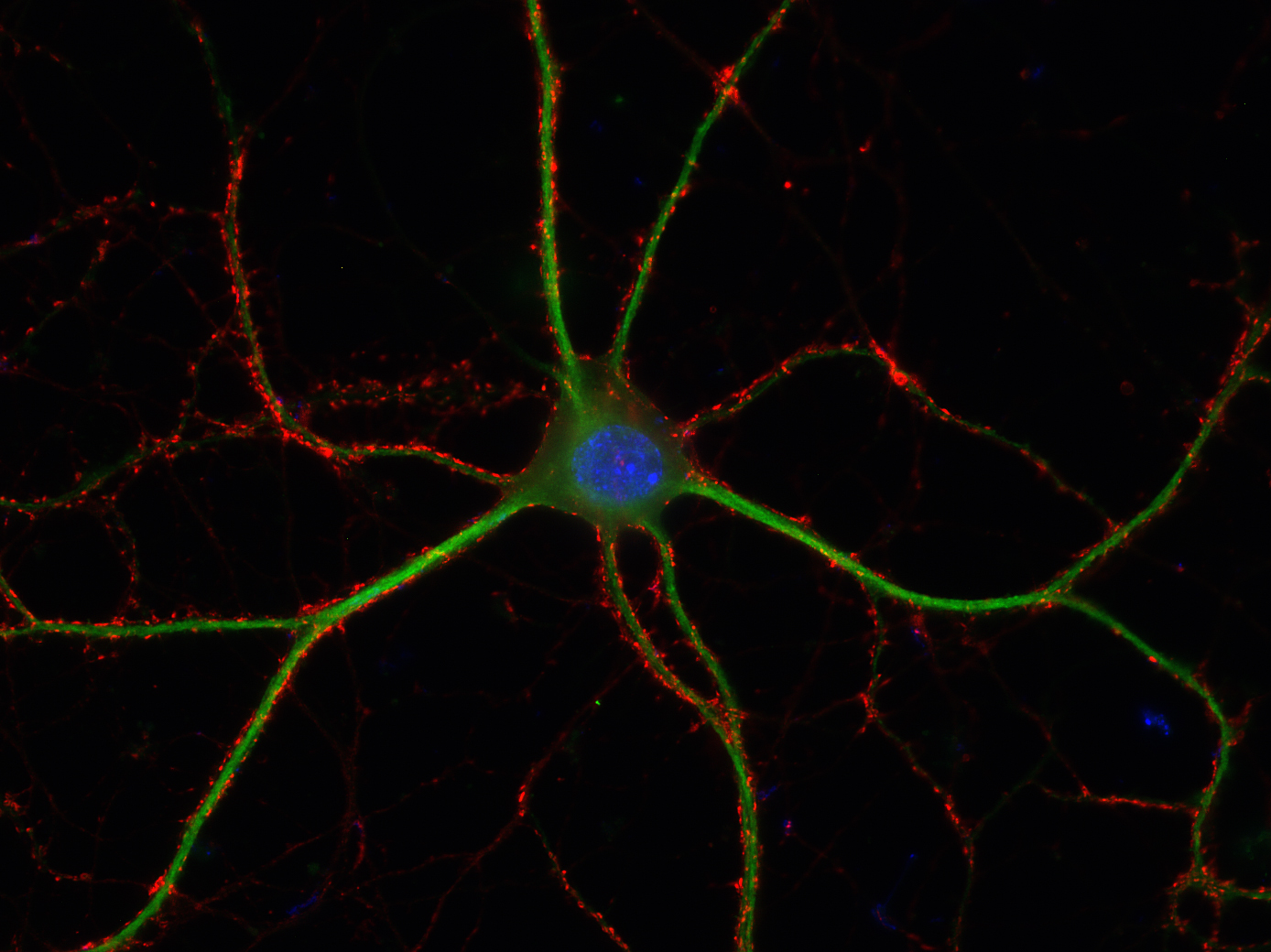 VGLUT1 Recombinant rabbit - image 2