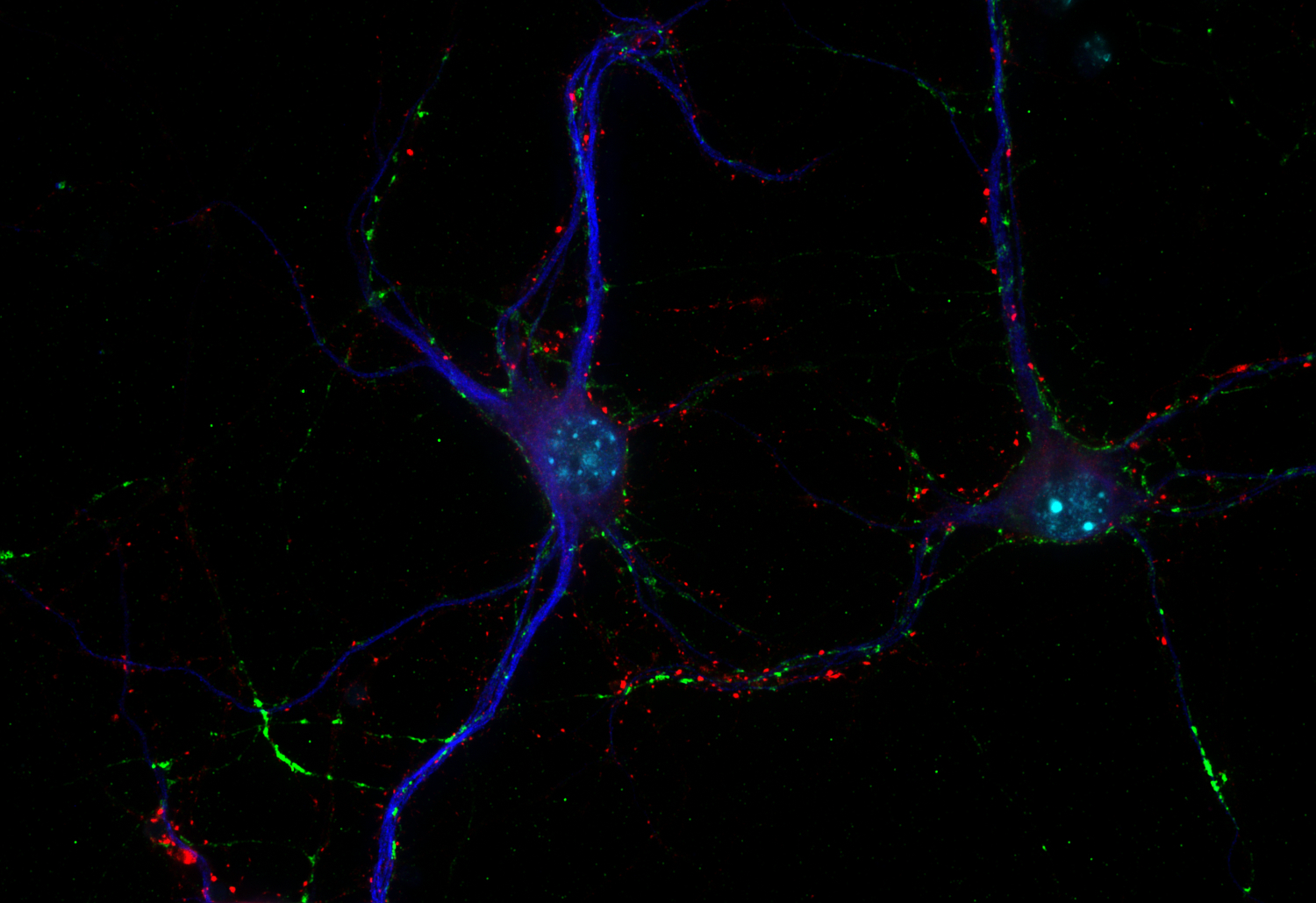 VGLUT1 Recombinant chicken - image 2