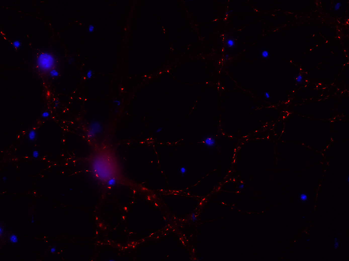 VGLUT2 Polyclonal rabbit antiserum - image 2
