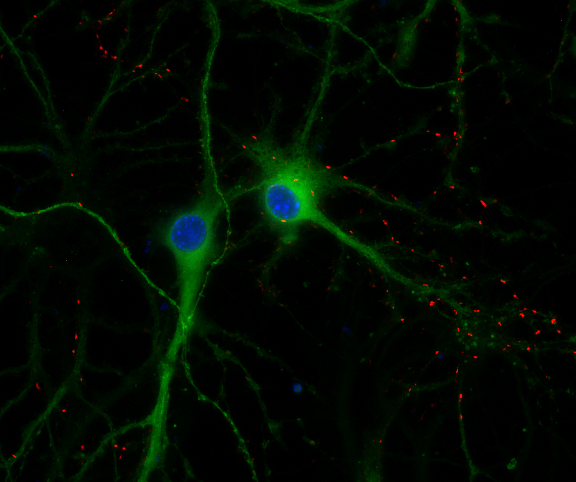 VGLUT2 Recombinant rabbit - image 2