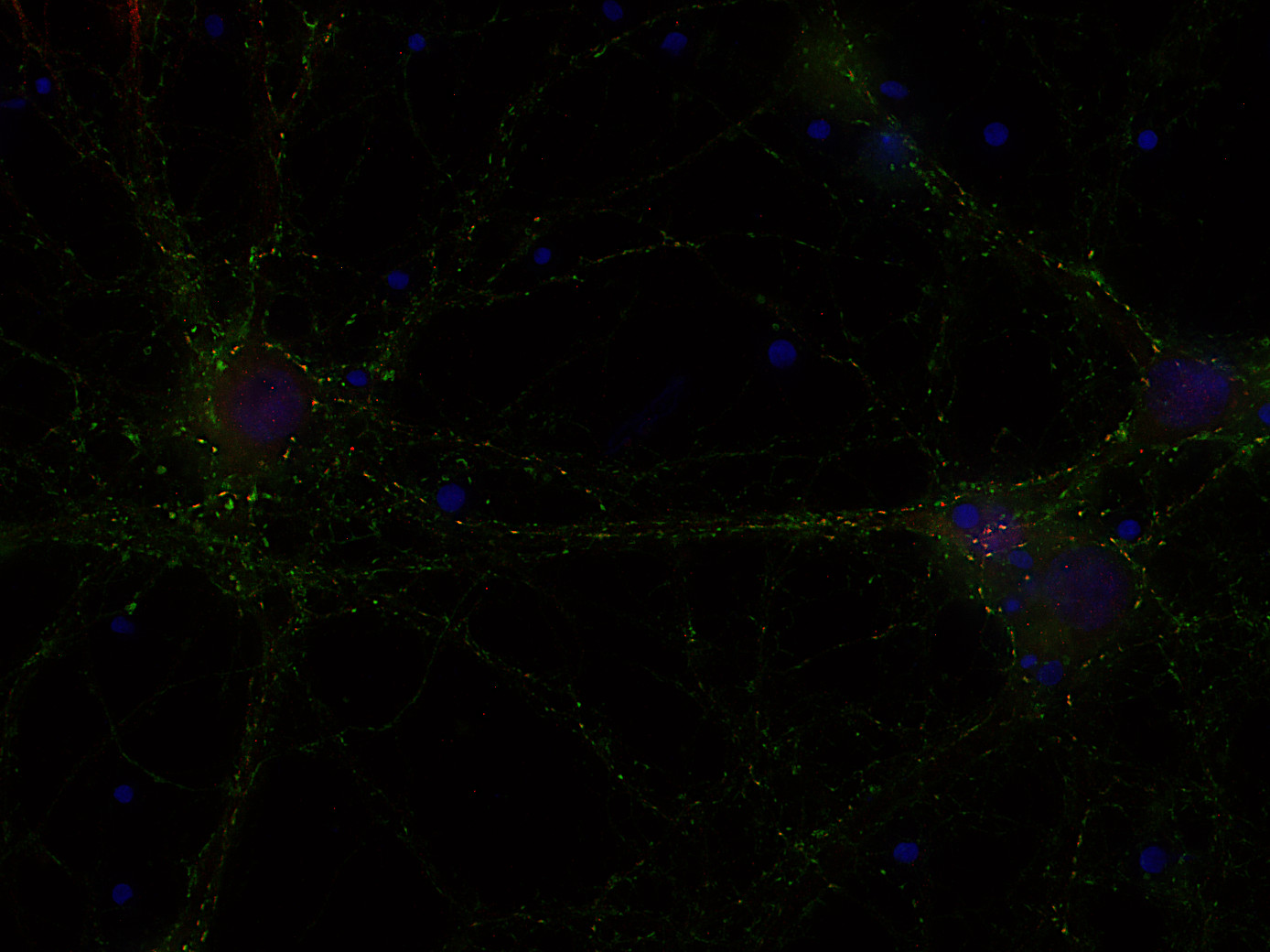 VAChT Recombinant rabbit - image 2