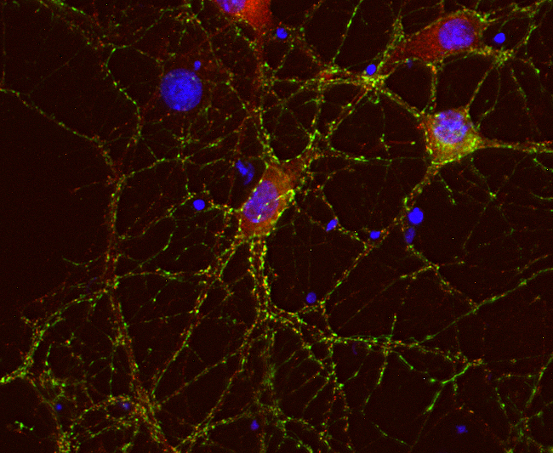 RIM1/2, Polyclonal Guinea pig purified antibody