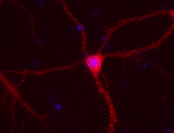 ERC1b/2 Polyclonal Guinea pig antiserum - image 2