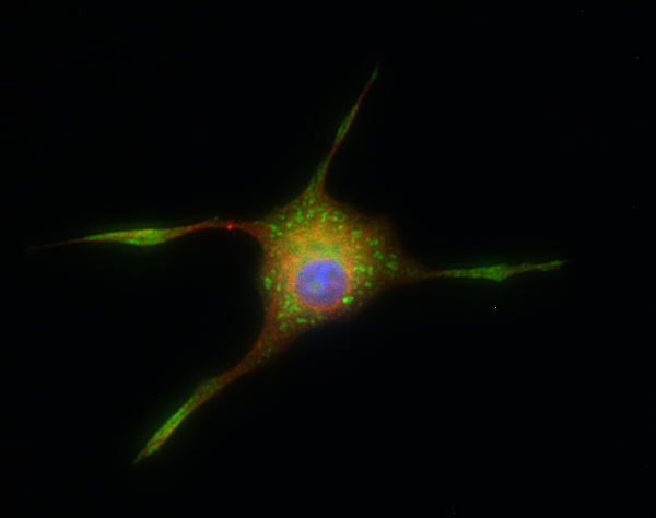 Snapin Polyclonal rabbit antiserum - image 1