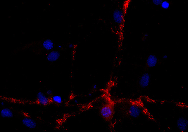 CSP Polyclonal Guinea pig antiserum - image 2