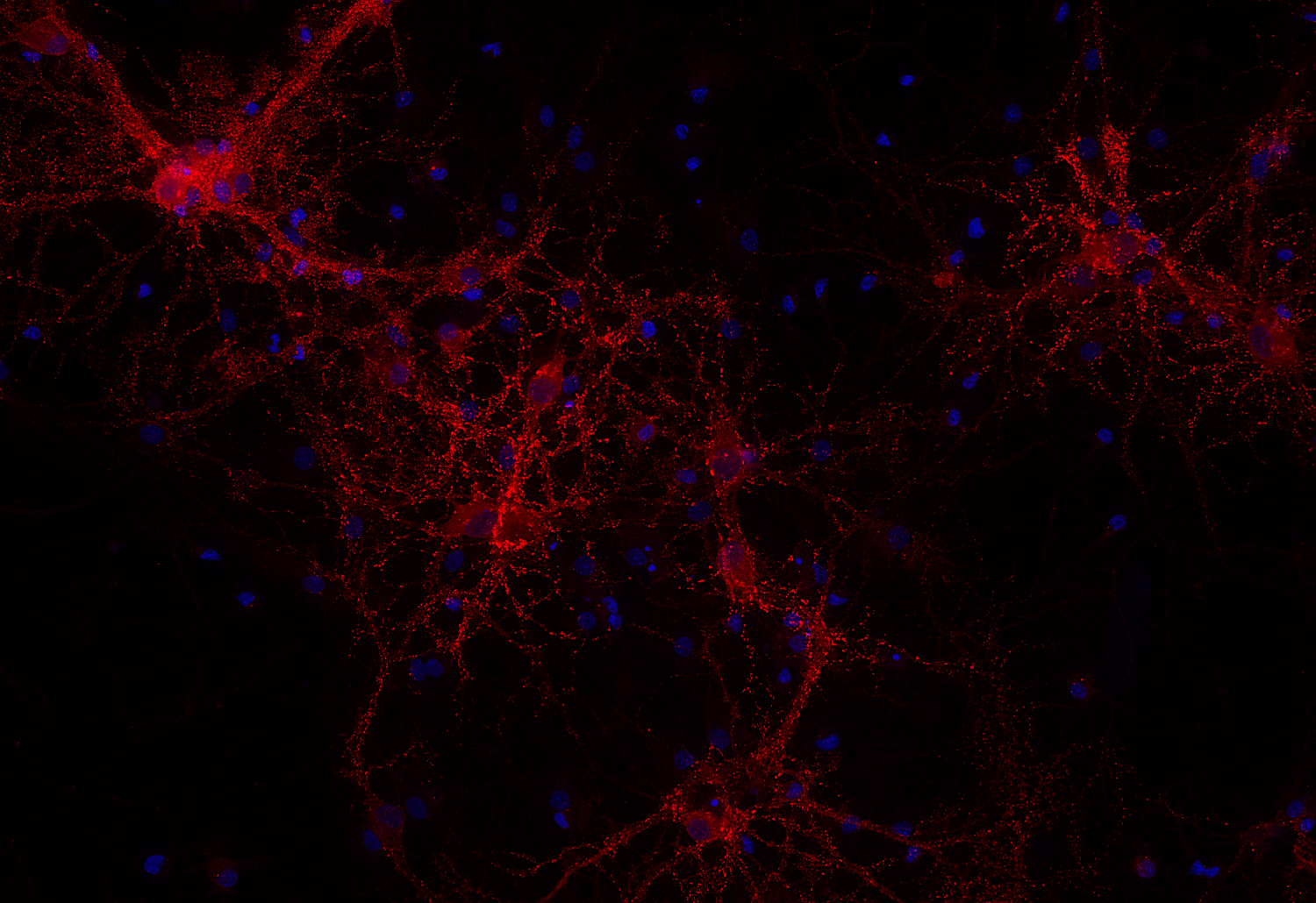 Homer1b/c Recombinant chicken - image 3