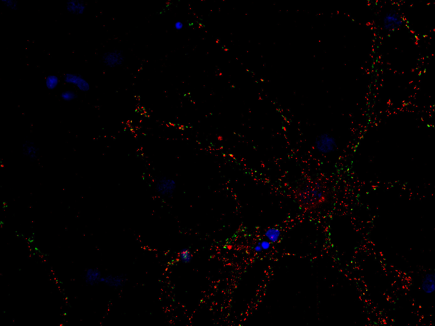 Homer1b/c Polyclonal rabbit antiserum - image 2