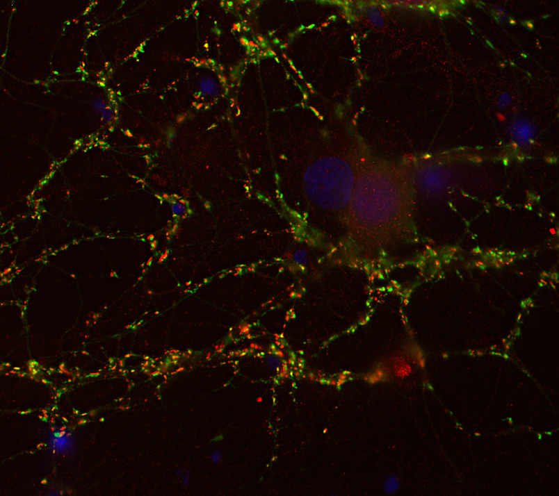 Homer1b/c, Polyclonal Guinea pig purified antibody