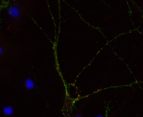 Shank1 Polyclonal rabbit purified antibody - image 2