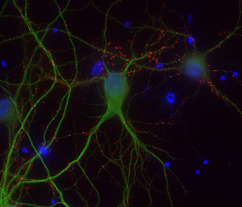 Shank1/2/3 Monoclonal mouse purified IgG - image 1
