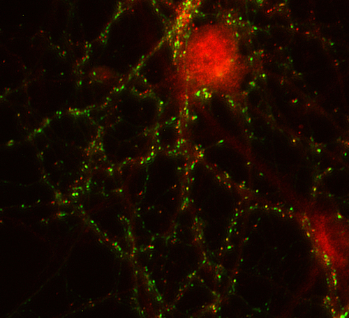 Shank2 Polyclonal rabbit antiserum - image 2