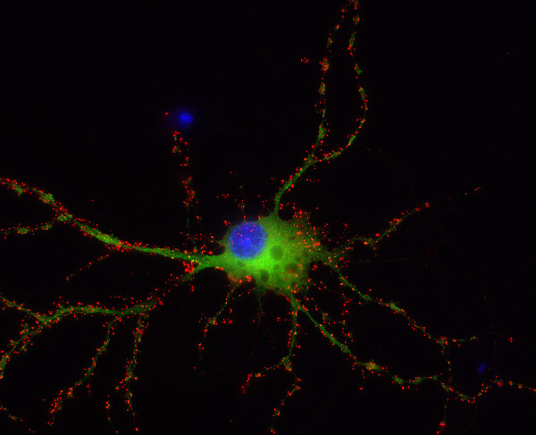 Shank2 Polyclonal Guinea pig antiserum - image 2