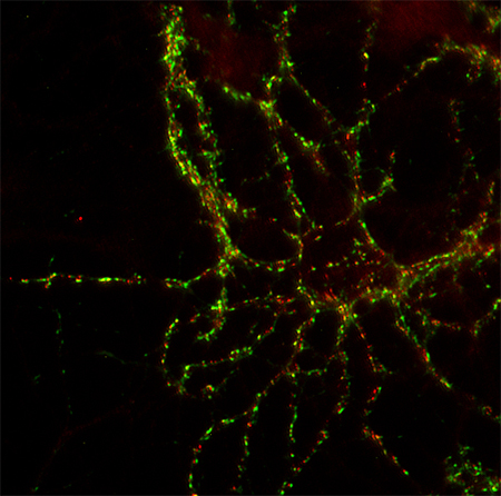 Shank3 Polyclonal rabbit antiserum - image 2