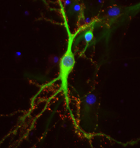 Shank3 Polyclonal Guinea pig antiserum - image 2