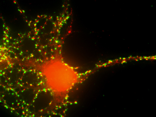 Synaptopodin Polyclonal rabbit antiserum - image 3