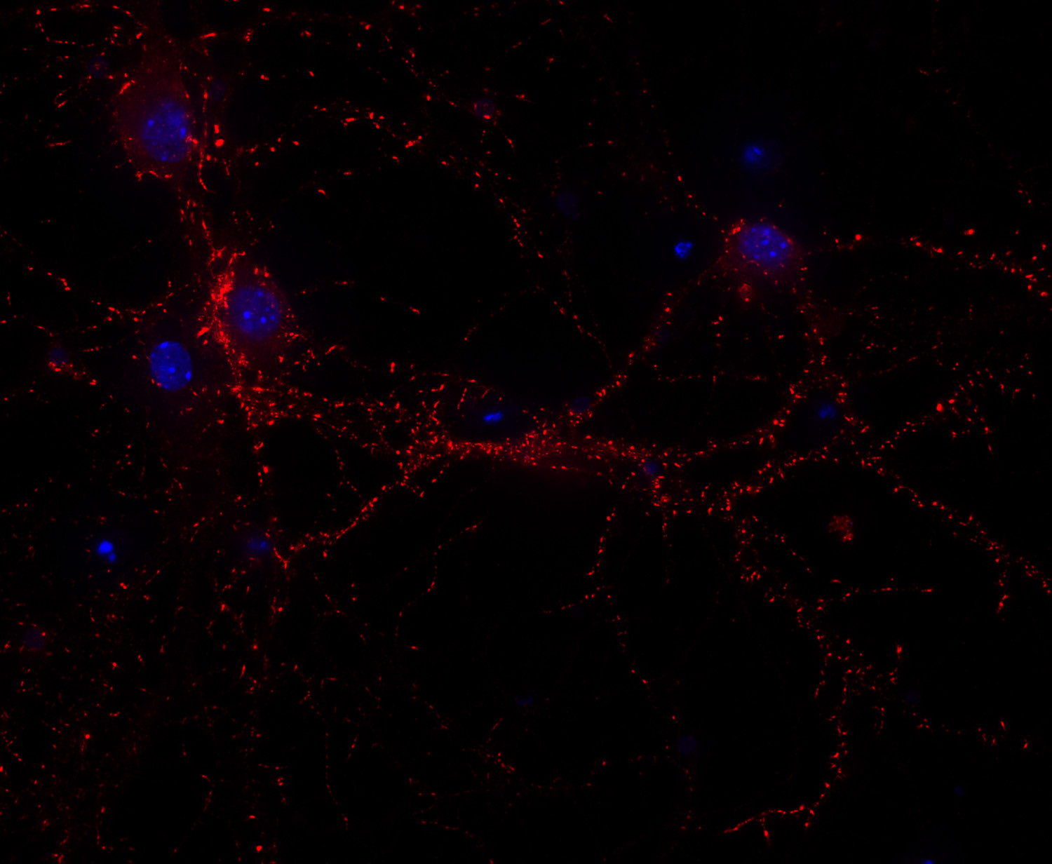 Synaptopodin Recombinant rabbit - image 3