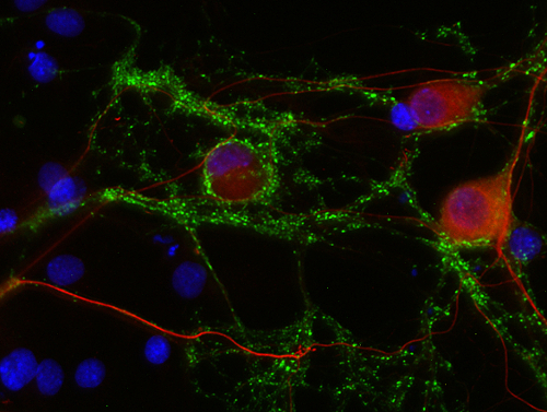 Neurofilament L Polyclonal rabbit antiserum - image 2