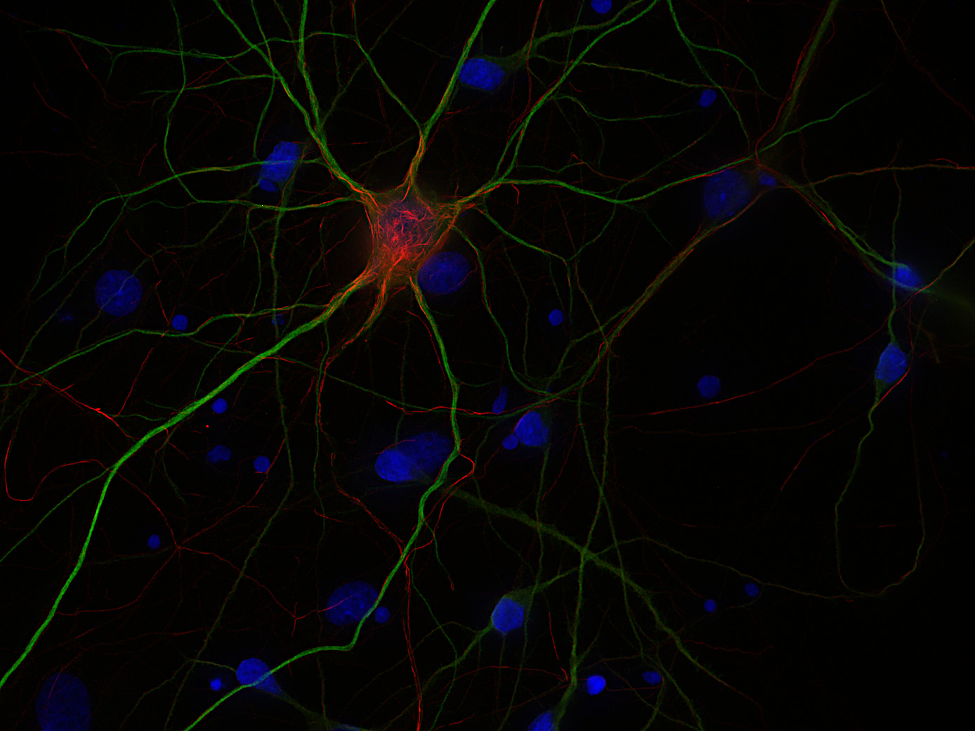 Neurofilament L Recombinant rabbit - image 2