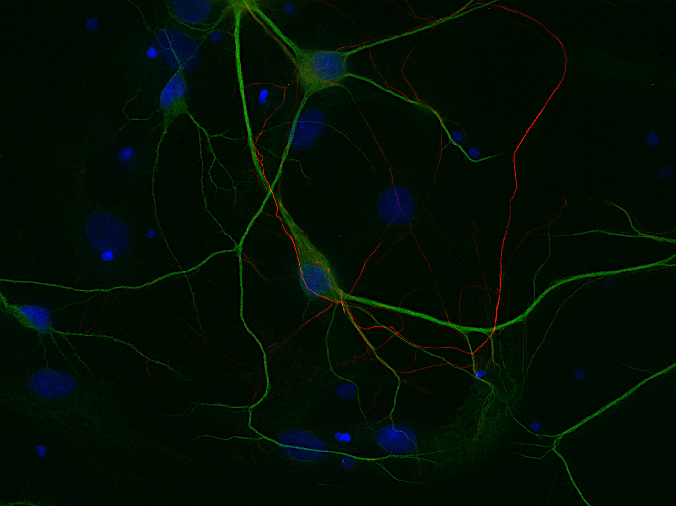 Neurofilament L Recombinant rabbit - image 3
