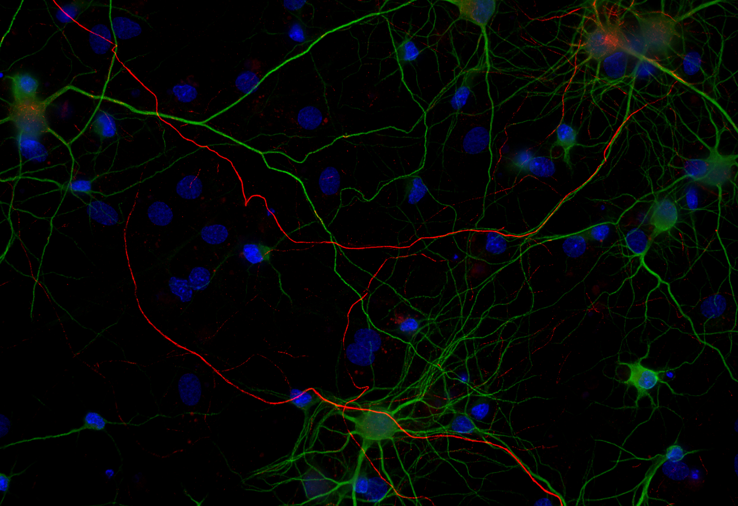 Neurofilament H Recombinant rabbit - image 2
