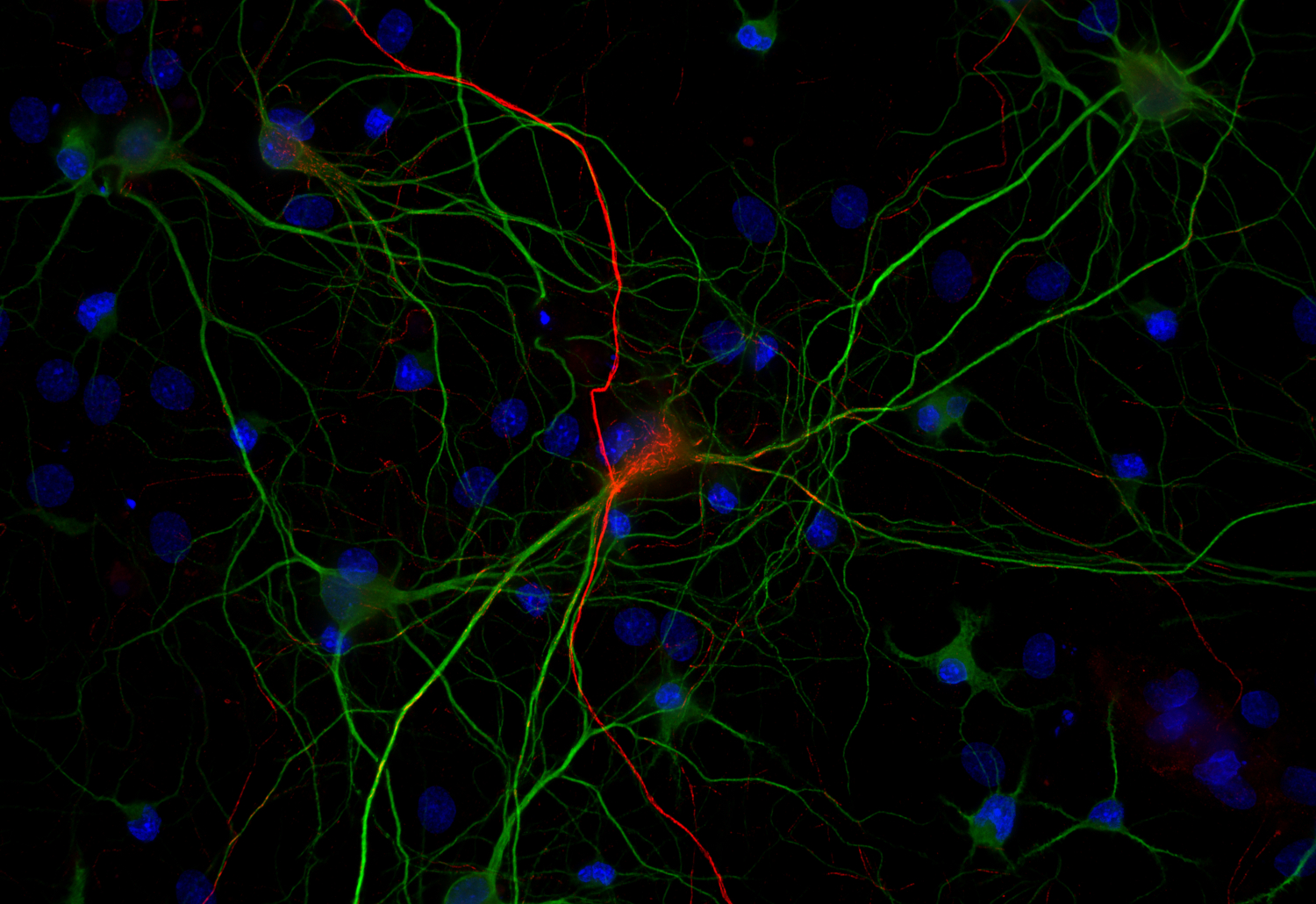 Neurofilament H Recombinant rabbit - image 3