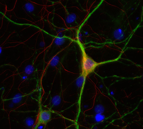 Neurofilament M Polyclonal rabbit antiserum - image 2