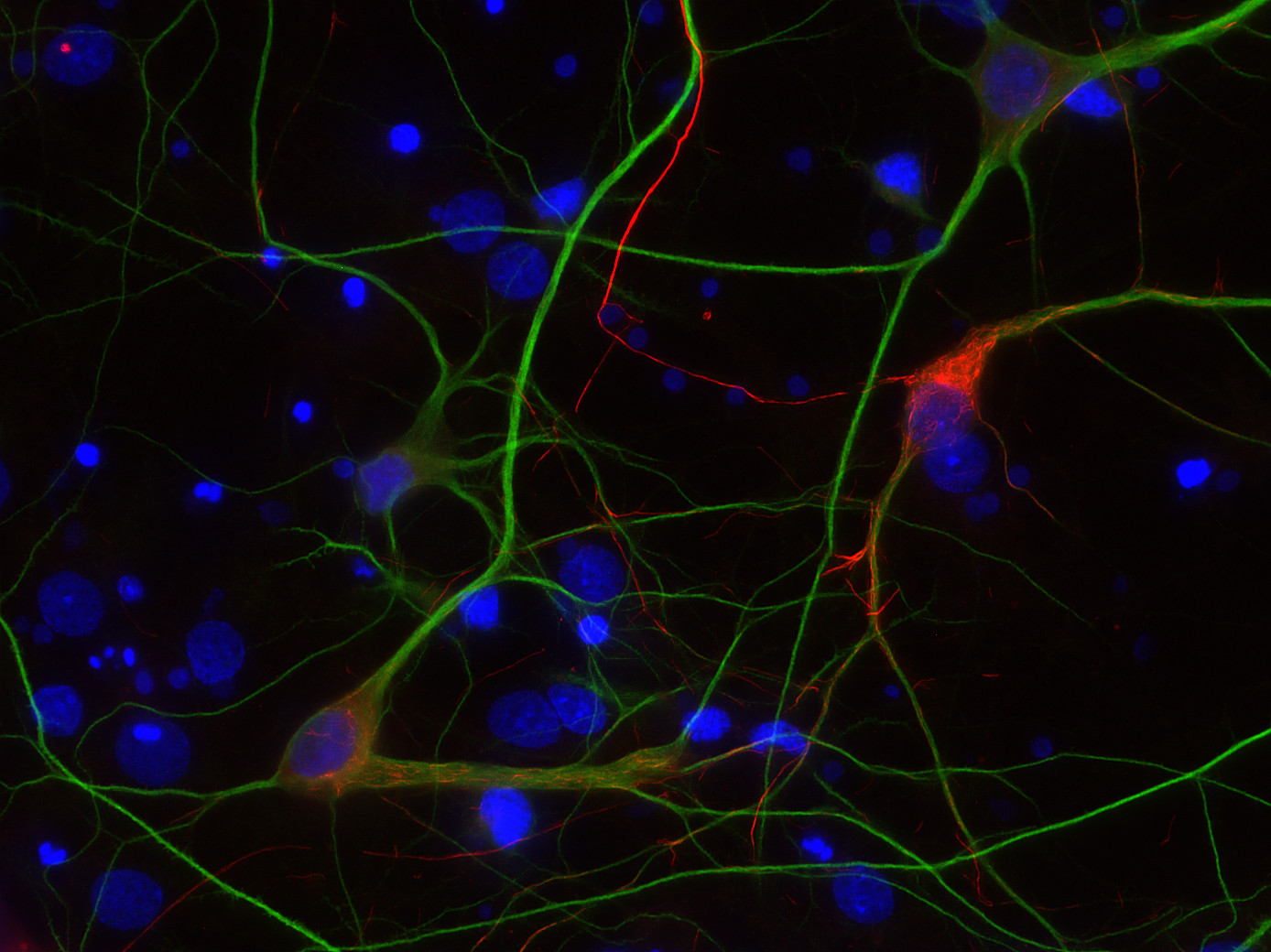 Neurofilament M Recombinant rabbit - image 2