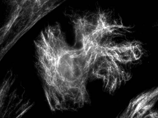 Vimentin Polyclonal rabbit antiserum - image 2